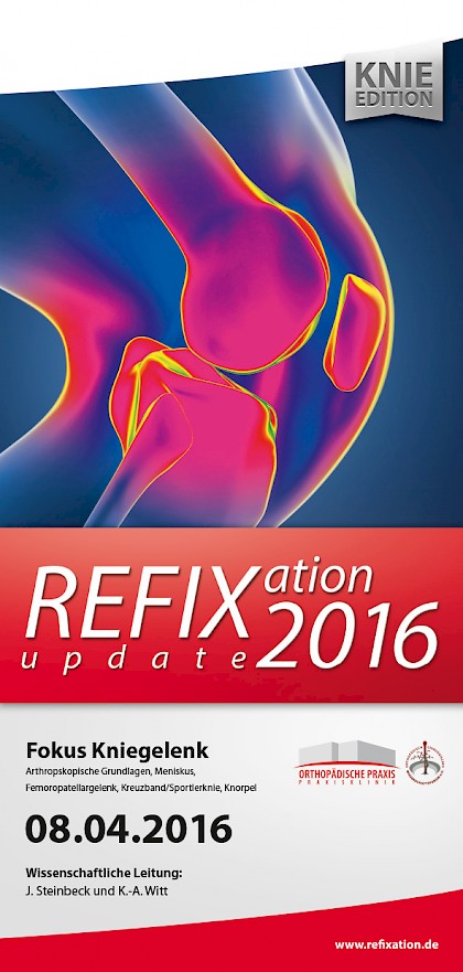 Refixation Update 2016 – Knie Edition