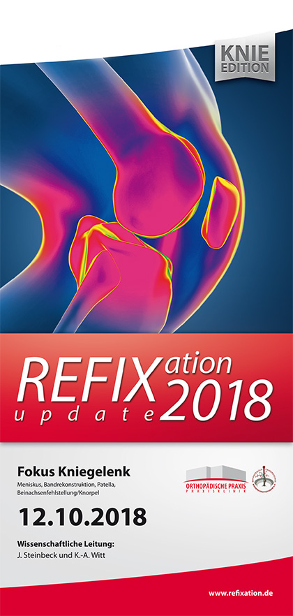 Refixation Update 2018 – Knie-Edition