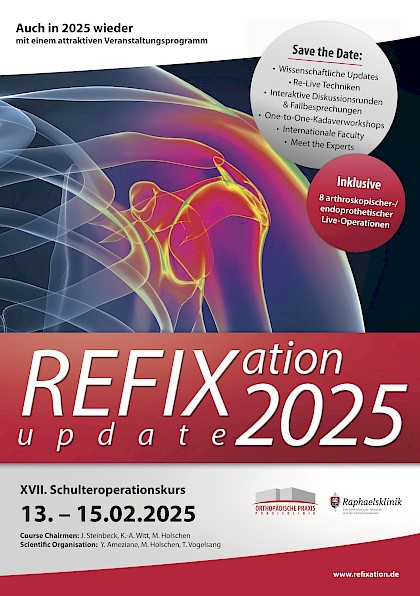 Refixation Update 2025 - DE